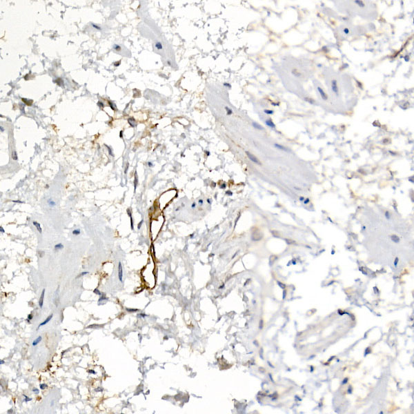 Podoplanin Rabbit Polyclonal Antibody - Image 3