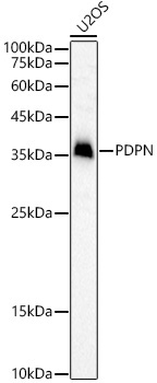 Podoplanin Rabbit Polyclonal Antibody