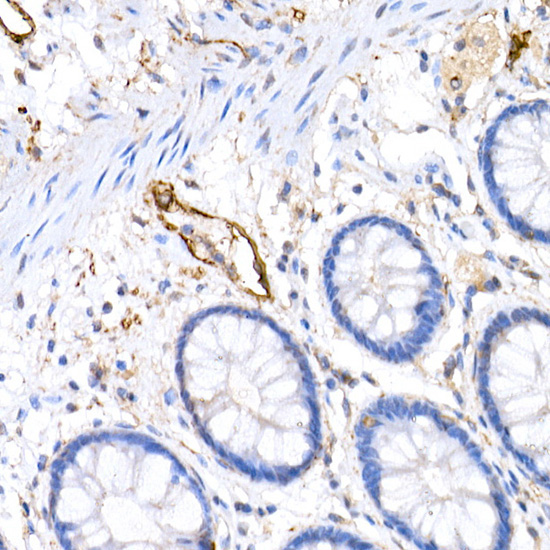 Podoplanin Rabbit Polyclonal Antibody - Image 3