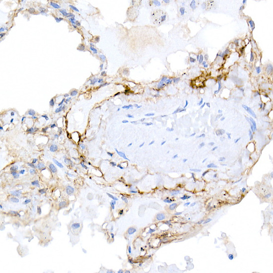 Podoplanin Rabbit Polyclonal Antibody - Image 4