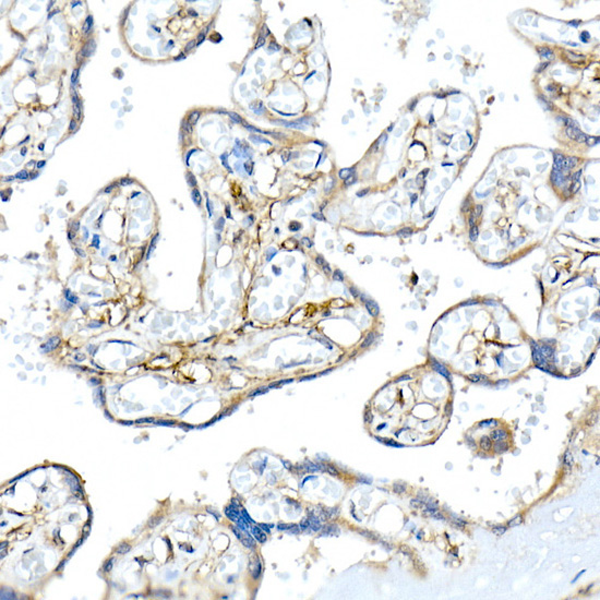 Podoplanin Rabbit Polyclonal Antibody - Image 5