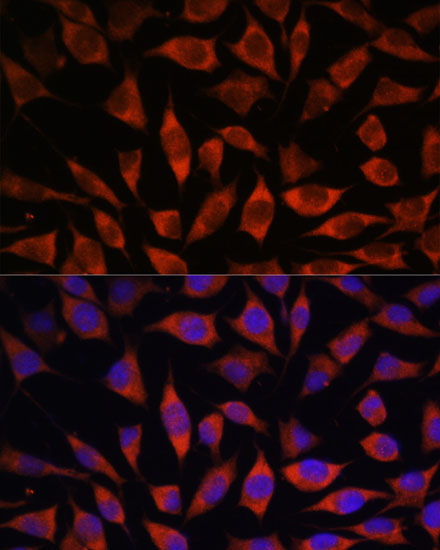 POGLUT1 Rabbit Polyclonal Antibody - Image 2