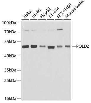 POLD2 Rabbit Polyclonal Antibody