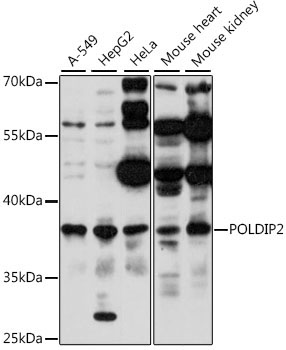 POLDIP2 Rabbit Polyclonal Antibody