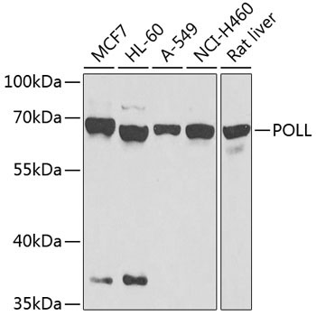 POLL Rabbit Polyclonal Antibody
