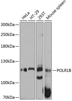 POLR1B Rabbit Polyclonal Antibody