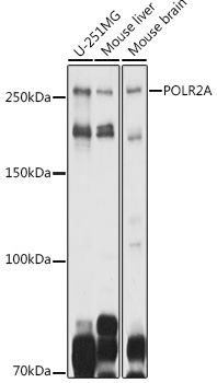 POLR2A Rabbit Polyclonal Antibody