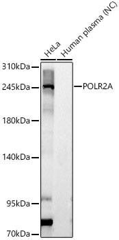 POLR2A Rabbit Polyclonal Antibody
