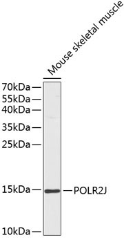 POLR2J Rabbit Polyclonal Antibody