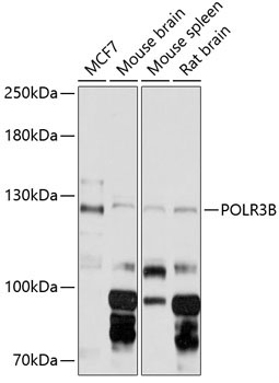 POLR3B Rabbit Polyclonal Antibody