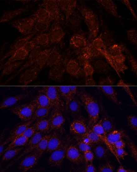 POLRMT Rabbit Polyclonal Antibody - Image 2