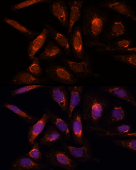 POLRMT Rabbit Polyclonal Antibody - Image 3