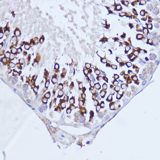Polyclonal AntibodyPC1 Rabbit Polyclonal Antibody - Image 2