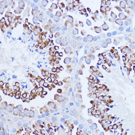 Polyclonal AntibodyPC1 Rabbit Polyclonal Antibody - Image 4