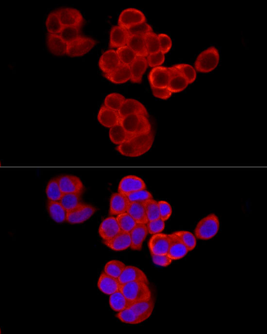 Polyclonal AntibodyPC1 Rabbit Polyclonal Antibody - Image 5