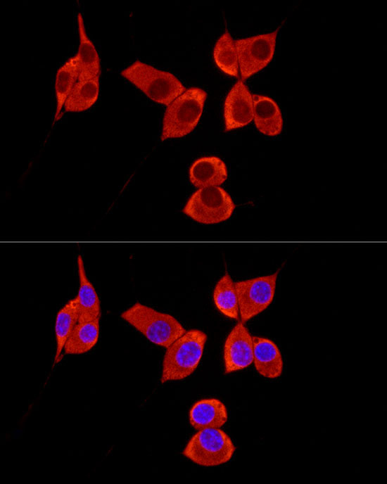 Polyclonal AntibodyPC1 Rabbit Polyclonal Antibody - Image 6