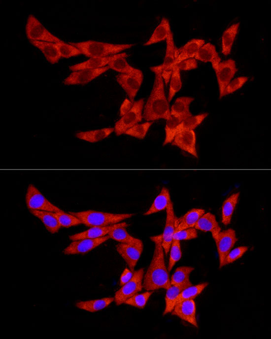 Polyclonal AntibodyPC1 Rabbit Polyclonal Antibody - Image 7