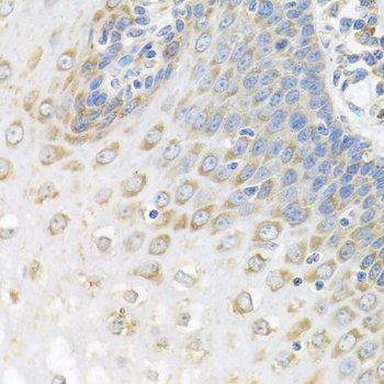 Polyclonal AntibodyPC4 Rabbit Polyclonal Antibody - Image 2