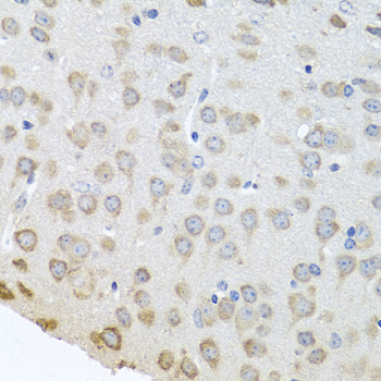 Polyclonal AntibodyPC4 Rabbit Polyclonal Antibody - Image 3