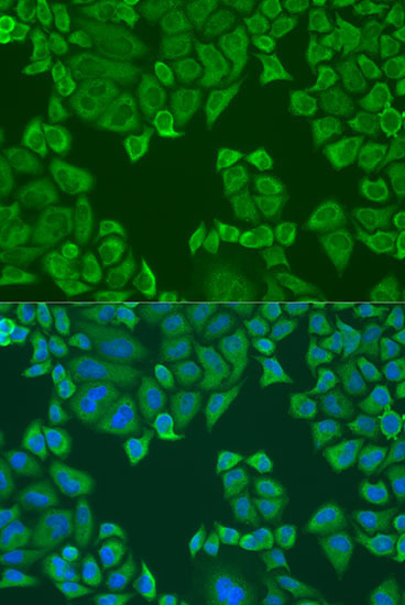 Polyclonal AntibodyPC4 Rabbit Polyclonal Antibody - Image 4