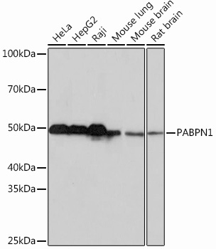 Polyclonal AntibodyPN1 Rabbit Monoclonal Antibody
