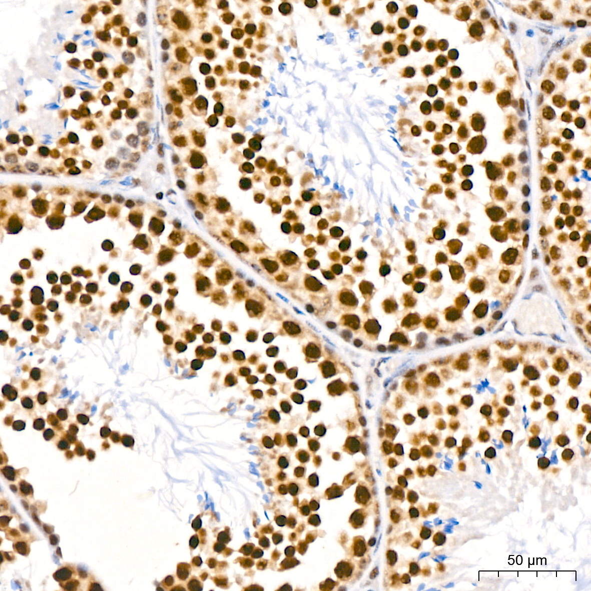 Polyclonal AntibodyPN1 Rabbit Monoclonal Antibody - Image 2
