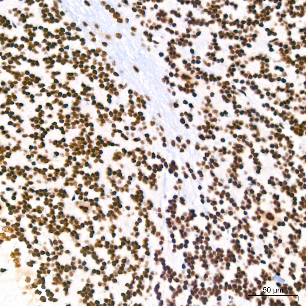 Polyclonal AntibodyPN1 Rabbit Monoclonal Antibody - Image 3