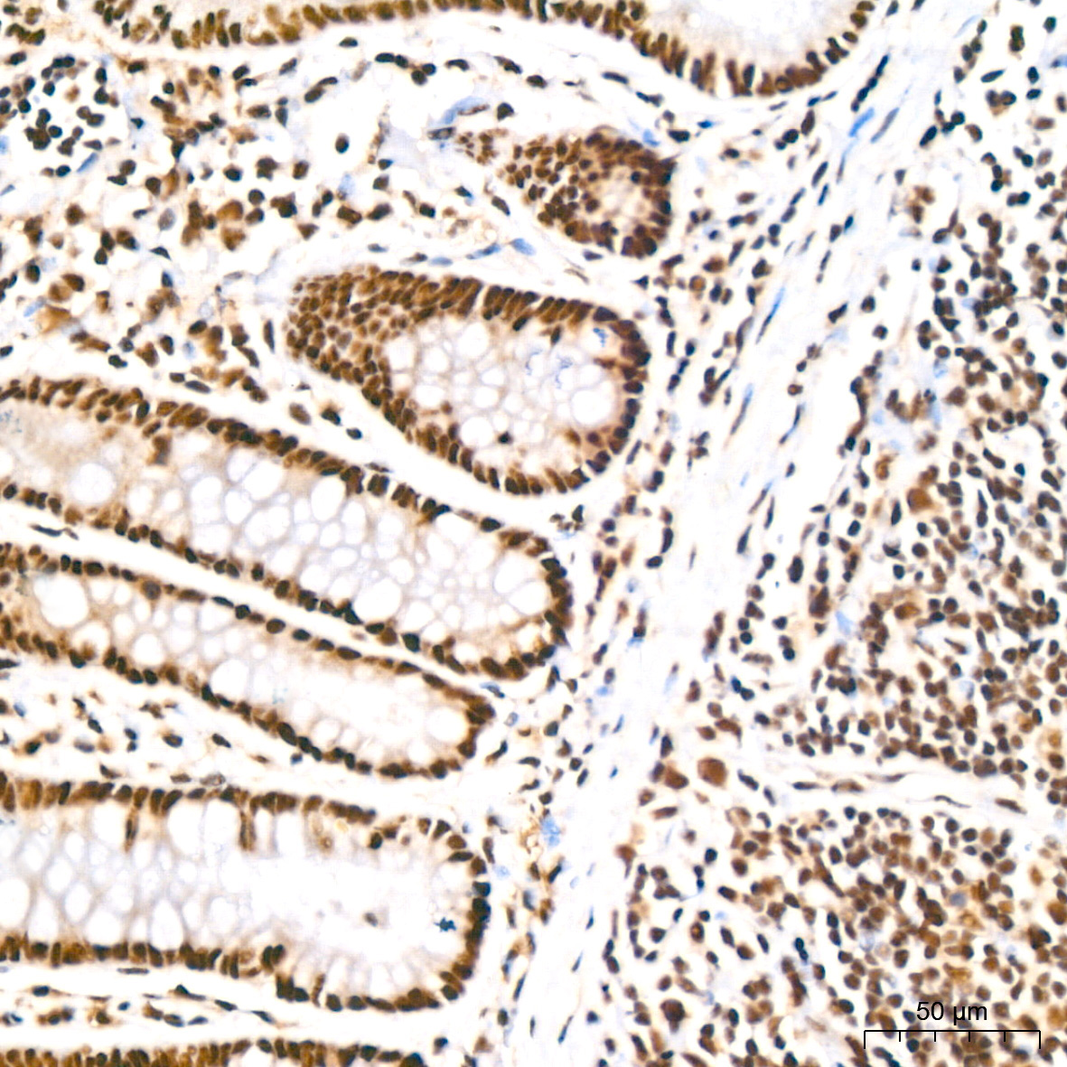 Polyclonal AntibodyPN1 Rabbit Monoclonal Antibody - Image 4