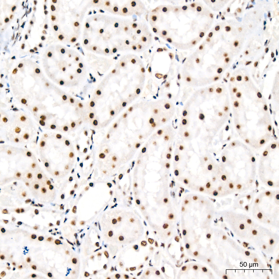 Polyclonal AntibodyPN1 Rabbit Monoclonal Antibody - Image 5