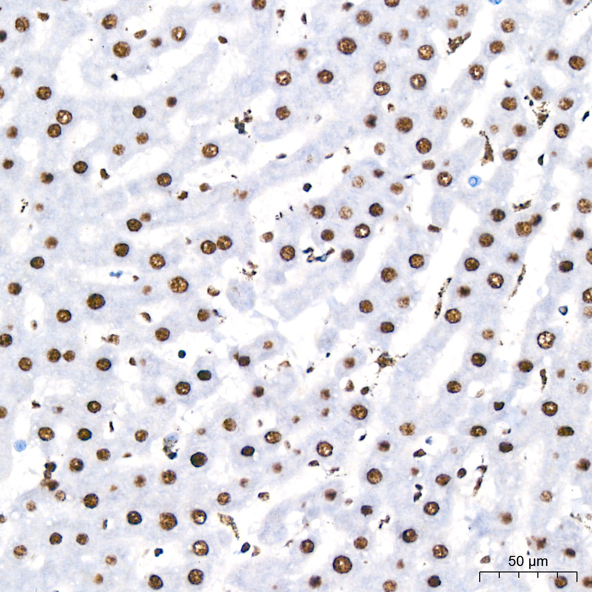 Polyclonal AntibodyPN1 Rabbit Monoclonal Antibody - Image 6