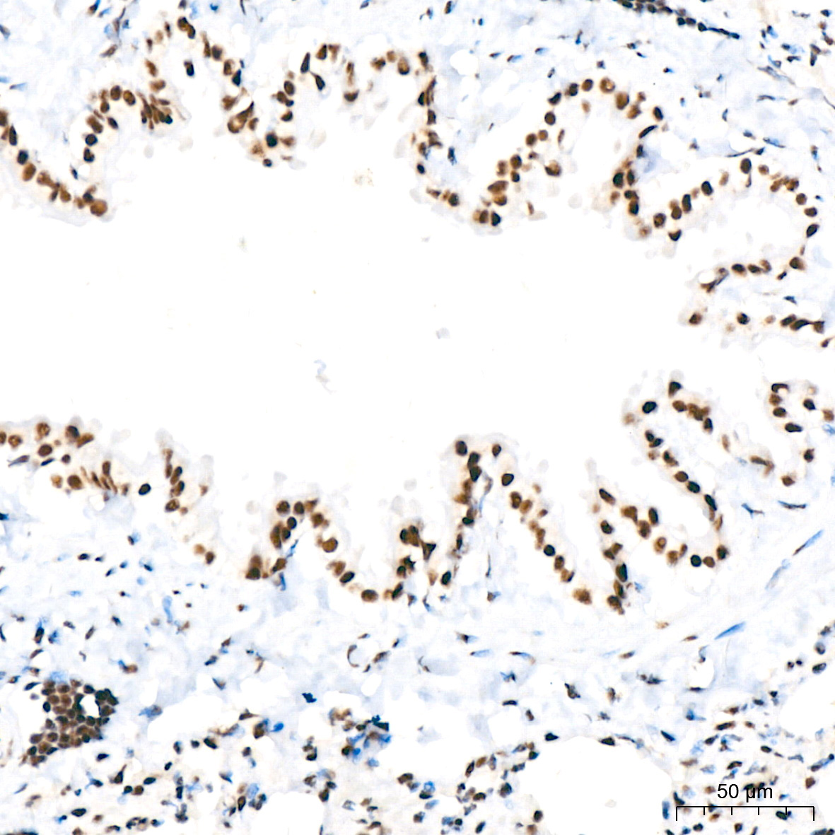 Polyclonal AntibodyPN1 Rabbit Monoclonal Antibody - Image 7