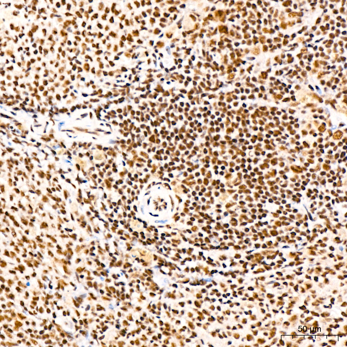 Polyclonal AntibodyPN1 Rabbit Monoclonal Antibody - Image 8