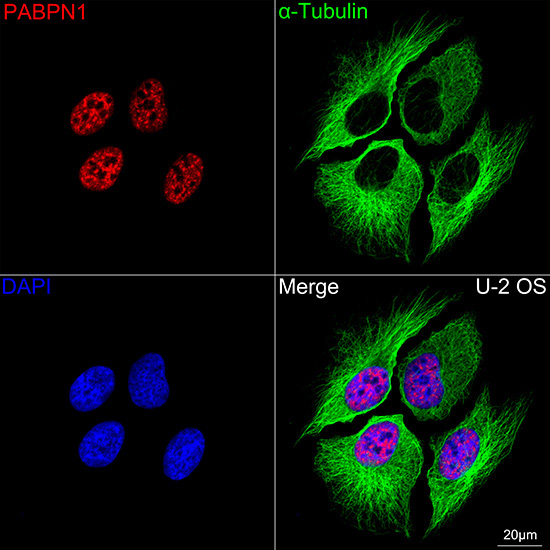 Polyclonal AntibodyPN1 Rabbit Monoclonal Antibody - Image 9