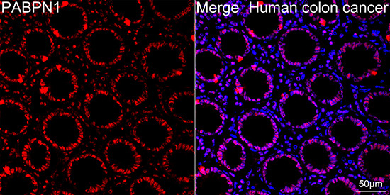 Polyclonal AntibodyPN1 Rabbit Monoclonal Antibody - Image 10