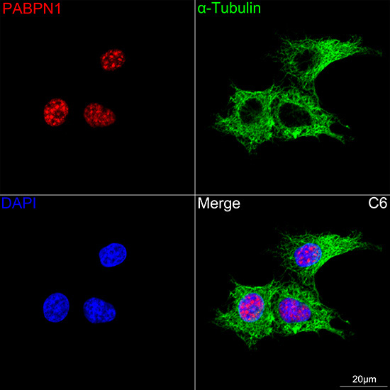 Polyclonal AntibodyPN1 Rabbit Monoclonal Antibody - Image 11
