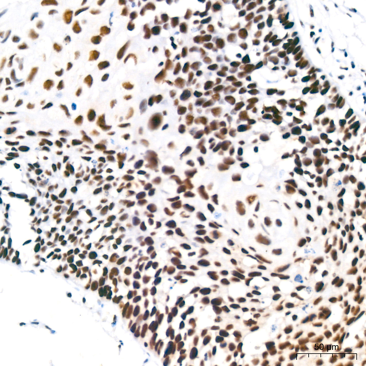 Polyclonal AntibodyPN1 Rabbit Monoclonal Antibody - Image 12