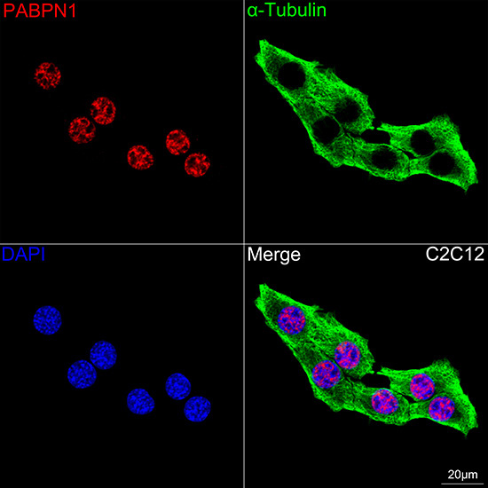 Polyclonal AntibodyPN1 Rabbit Monoclonal Antibody - Image 13