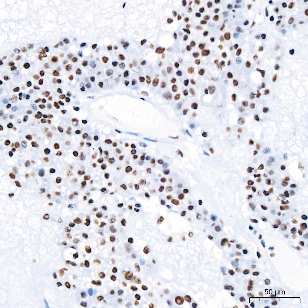Polyclonal AntibodyPN1 Rabbit Monoclonal Antibody - Image 14