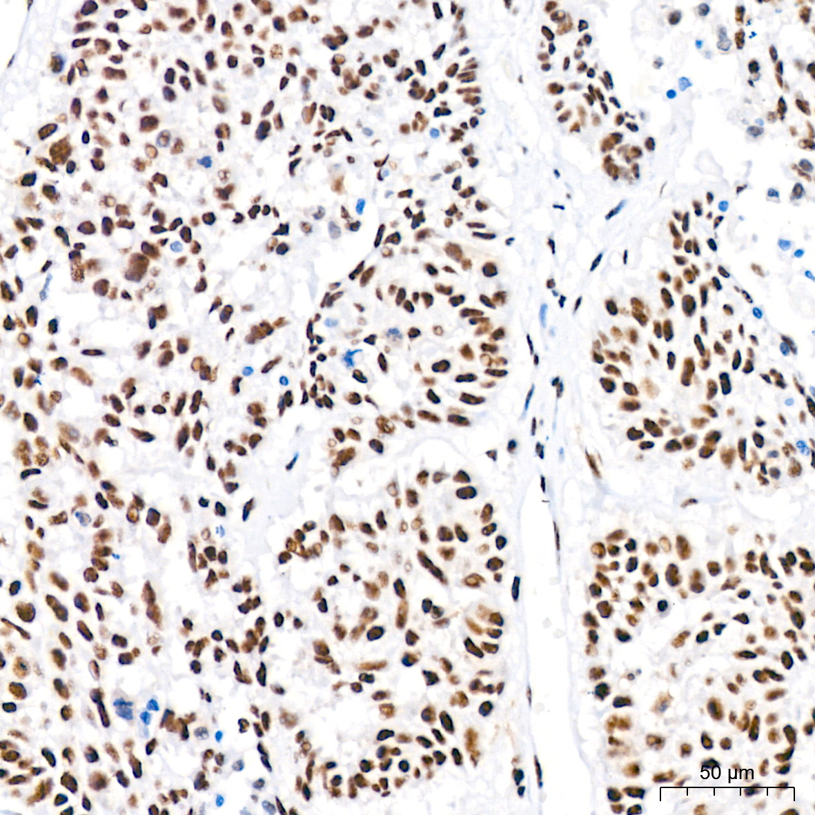Polyclonal AntibodyPN1 Rabbit Monoclonal Antibody - Image 15
