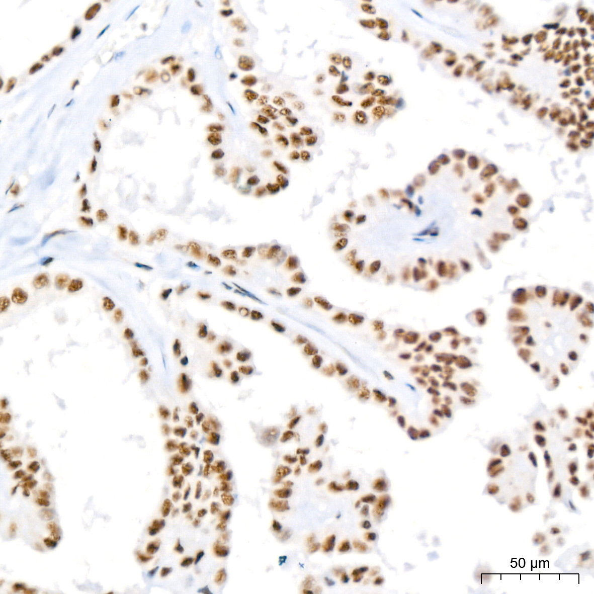 Polyclonal AntibodyPN1 Rabbit Monoclonal Antibody - Image 16