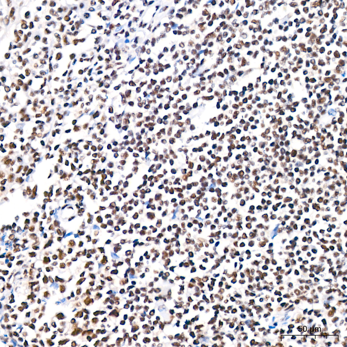 Polyclonal AntibodyPN1 Rabbit Monoclonal Antibody - Image 17