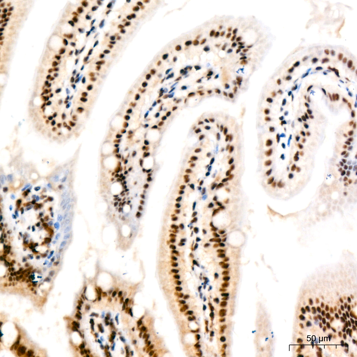 Polyclonal AntibodyPN1 Rabbit Monoclonal Antibody - Image 18