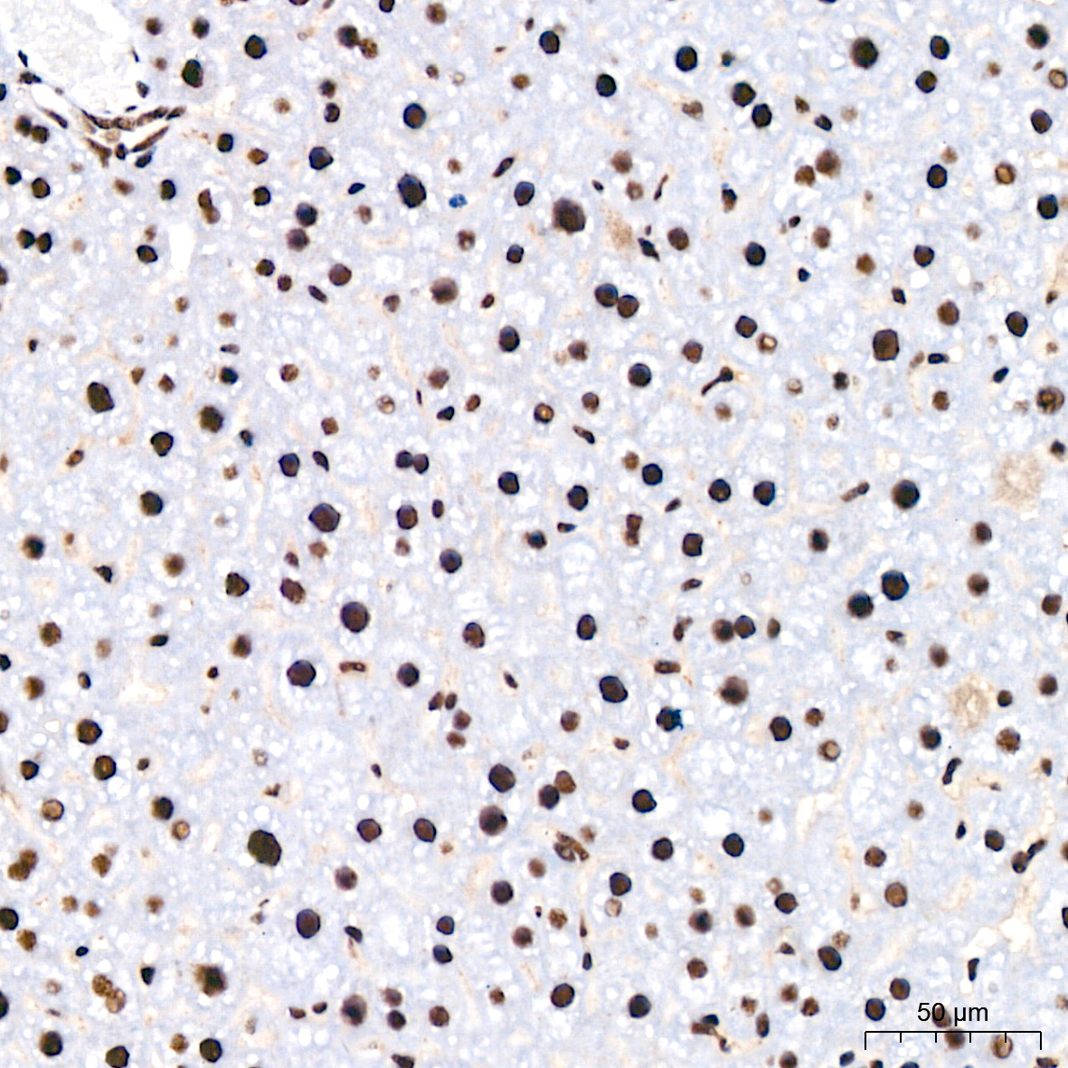 Polyclonal AntibodyPN1 Rabbit Monoclonal Antibody - Image 19