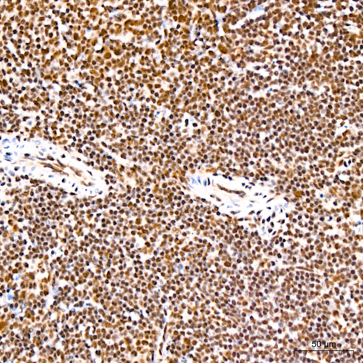 Polyclonal AntibodyPN1 Rabbit Monoclonal Antibody - Image 20