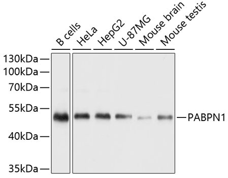 Polyclonal AntibodyPN1 Rabbit Polyclonal Antibody