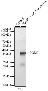 POMC Rabbit Polyclonal Antibody