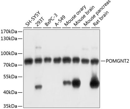 POMGNT2 Rabbit Polyclonal Antibody