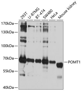 POMT1 Rabbit Polyclonal Antibody