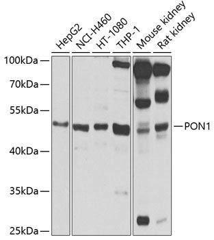 PON1 Rabbit Polyclonal Antibody