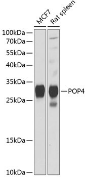 POP4 Rabbit Polyclonal Antibody